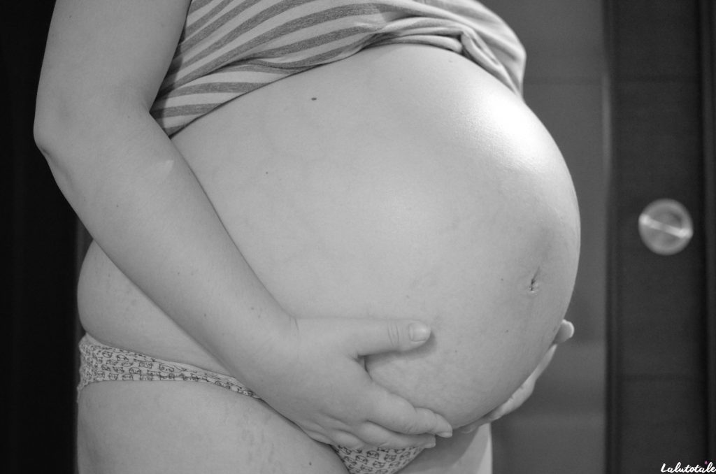 accouchement récit histoire maternité naissance césarienne urgence