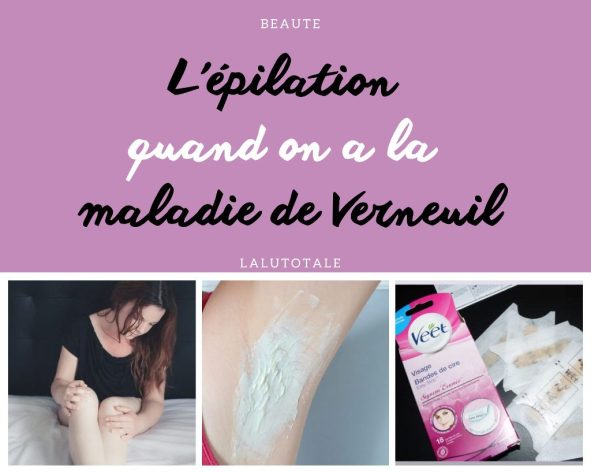 Les poils et l&rsquo;épilation quand on a la maladie de Verneuil.